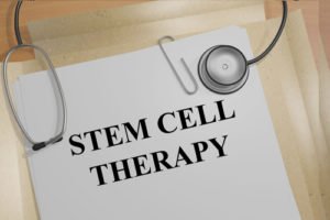 Are Stem Cell Injections Permanent?