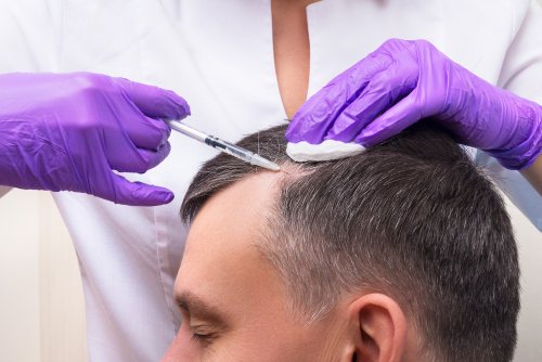 How Often Should PRP be Done for Hair? | HealthGAINS