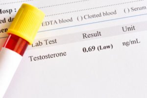 What Are the Symptoms of Low T?