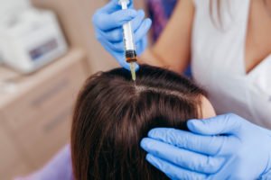 Who Is a Good Candidate for PRP Hair Treatment